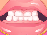 Bad Teeth