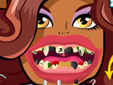 Clawdeen Wolf Bad Teeth